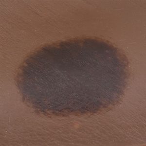 Seymour II Wound Care Model™, Dark
