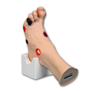 Wilma Wound Foot™, Light