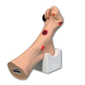 Wilma Wound Foot™, Light