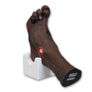 Wilma Wound Foot™, Dark