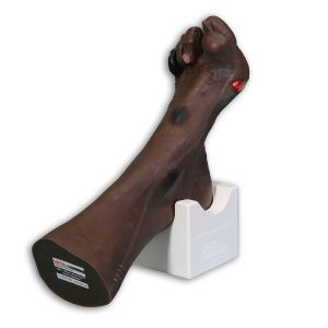 Wilma Wound Foot™, Dark