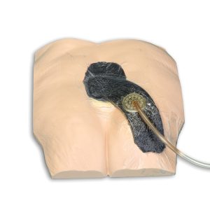 Stan™ Stage 4 Pressure Ulcer Model, Light
