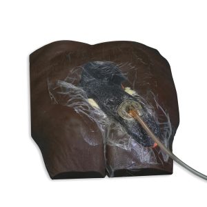 Stan™ Stage 4 Pressure Ulcer Model, Dark